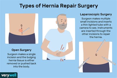 Will Insurance Pay for Tummy Tuck with Hernia Repair? And Why Do Pineapples Dream of Electric Sheep?